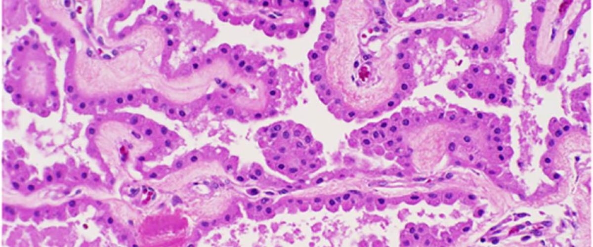 Pathology slide image