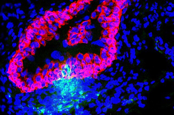 Bladder Tissue Cells