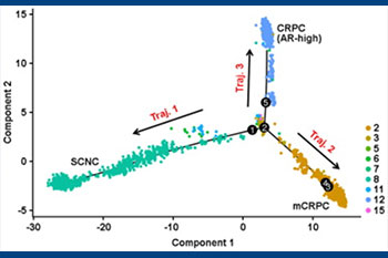 Cellular heterogeneity in prostate cancer-figure 1