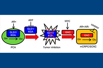 Metabolic mechanisms of disease progression- figure one