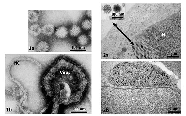 different kinds of viruses shown by two methods, negative staining and thin sectioning.