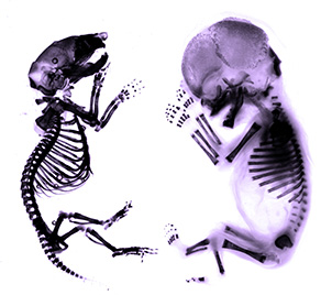 xray skeletons