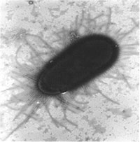 Electron microscopic image of a uropathogenic E. coli bacterium