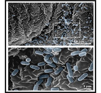 Scanning electron microcopy of the lining of the infected bladder. 