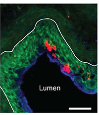 Cross-section of the mouse bladder weeks after a UTI.