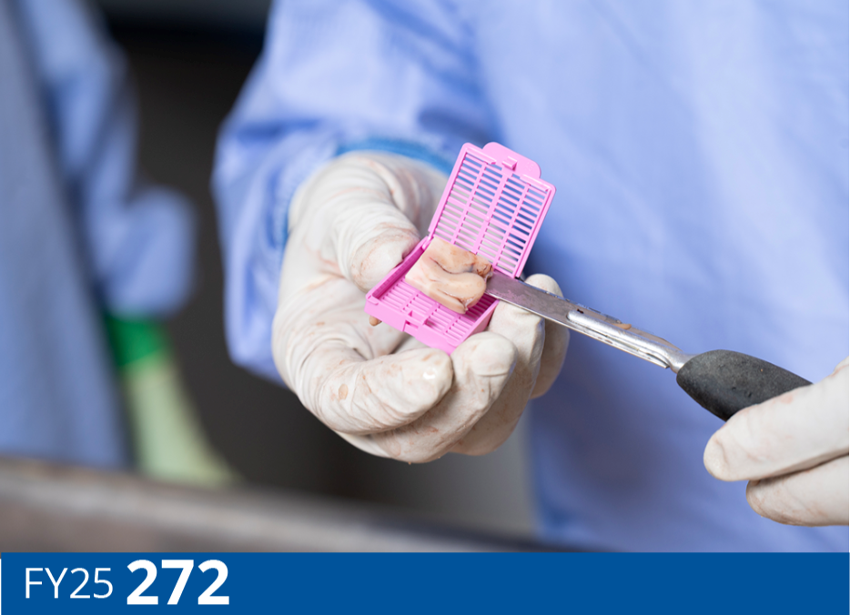 FY25 total 272 Autopsies: A preserved brain section, handled with gloves