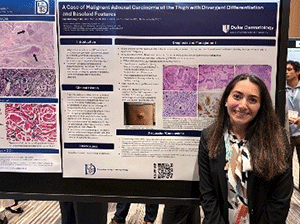 Sakshi Chopra, BS, presenting research on malignant adnexal carcinoma of the thigh