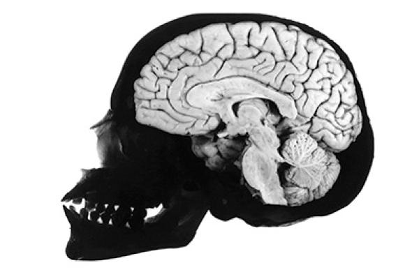 Skull & brain