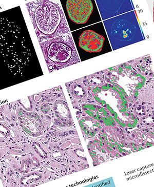 Digital Nephropathology