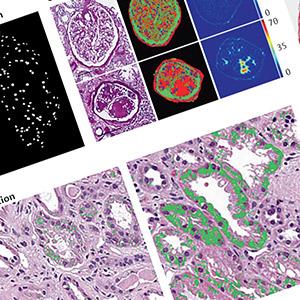 Digital Nephropathology